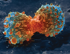 Lung_cancer_cell_during_cell_division-NIH.jpg